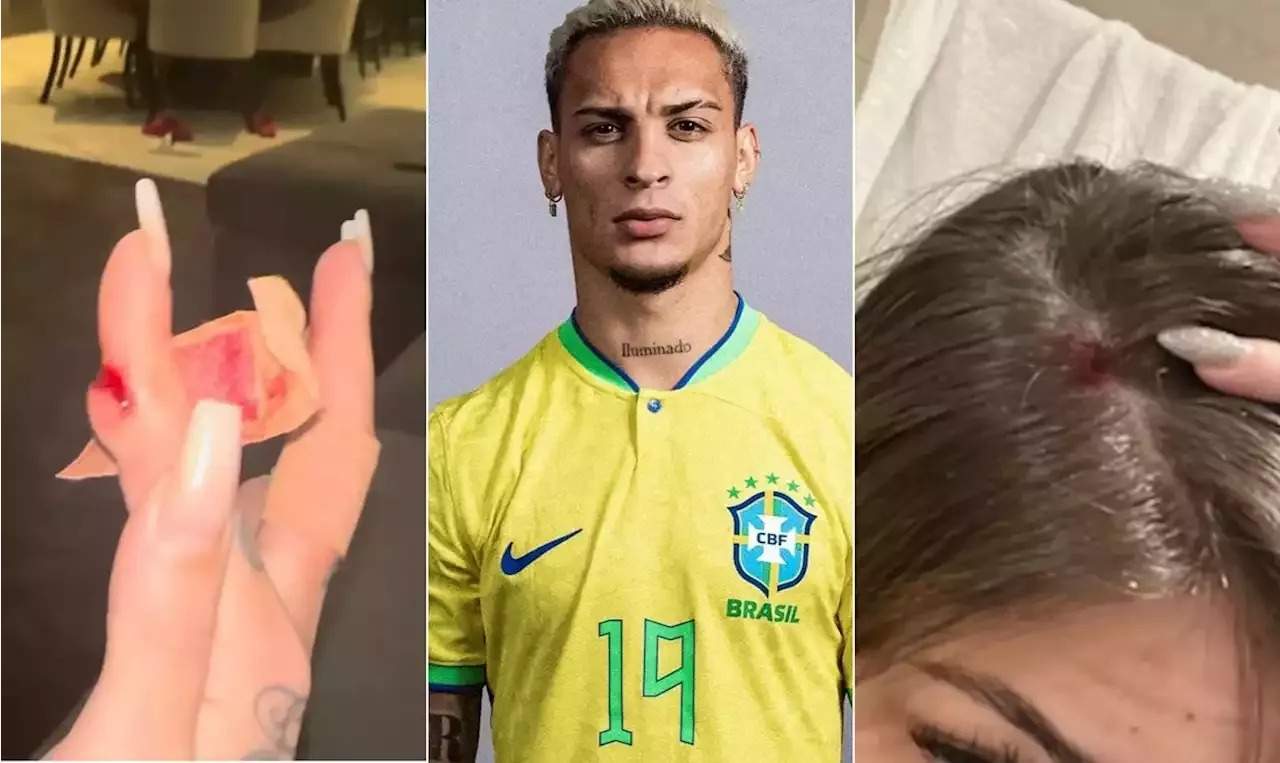 Eski kız arkadaşına saldıran dünya yıldızı, milli takım karosundan çıkarıldı! - Brezilya Futbol Federasyonu, eski kız arkadaşına fiziksel saldırıda bulunduğu iddiasıyla Manchester Unitedlı futbolcu Antony'yi milli takım kadrosundan çıkardığını duyurdu.